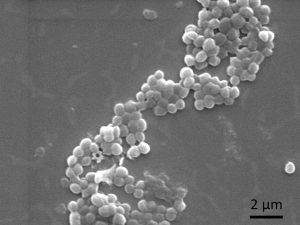 Links: Rasterelektronenmikroskopische Aufnahme zeigt deutlich weniger Bakterien auf der Titanprobe mit Silbernanopartikeln (rechts) im Vergleich zur Referenzprobe ohne Silber (links). 