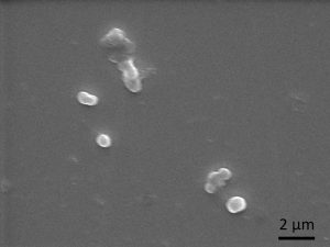 Rechts: Rasterelektronenmikroskopische Aufnahme zeigt deutlich weniger Bakterien auf der Titanprobe mit Silbernanopartikeln (rechts) im Vergleich zur Referenzprobe ohne Silber (links). 